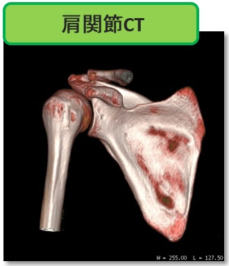 『CT検査』検査の概要とながれについて解説