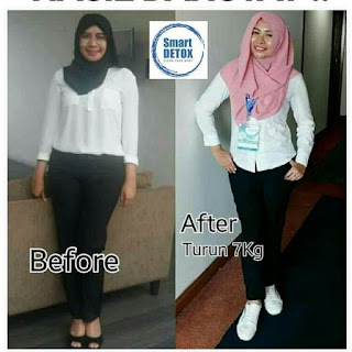 Jual Paket Easy Pack Smart Detox di Area Dako Pemean, Tolitoli Hubungi: 6281319308376