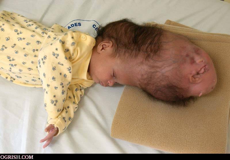 STRANGE FACTS WORLD WIDE; AMAZING FACTS; WORLD WIDE; STRANGE BABY WITH