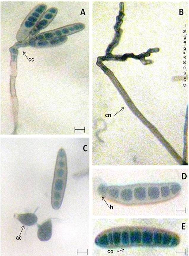 giardia și sarcina timpurie