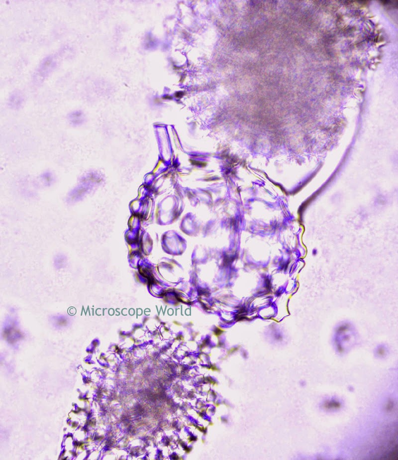 Radiolaria at 400x under microscope