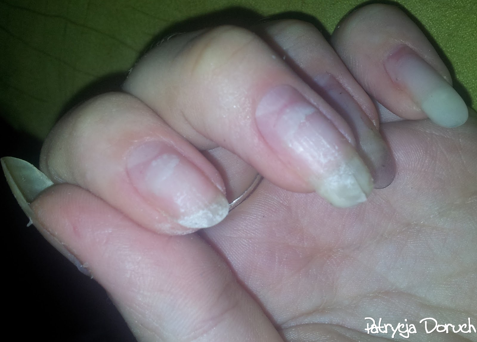Jak zabiłam moje paznokcie, czyli ściąganie żelu. Patrycja Doruch