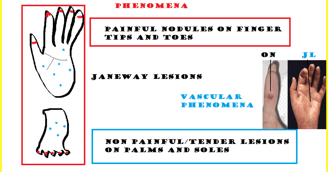 mbbs medicine humanity first difference between osler s node and