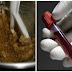 The doctors are SHOCKED: Three spoons of this mixture a day will restore the blood count!