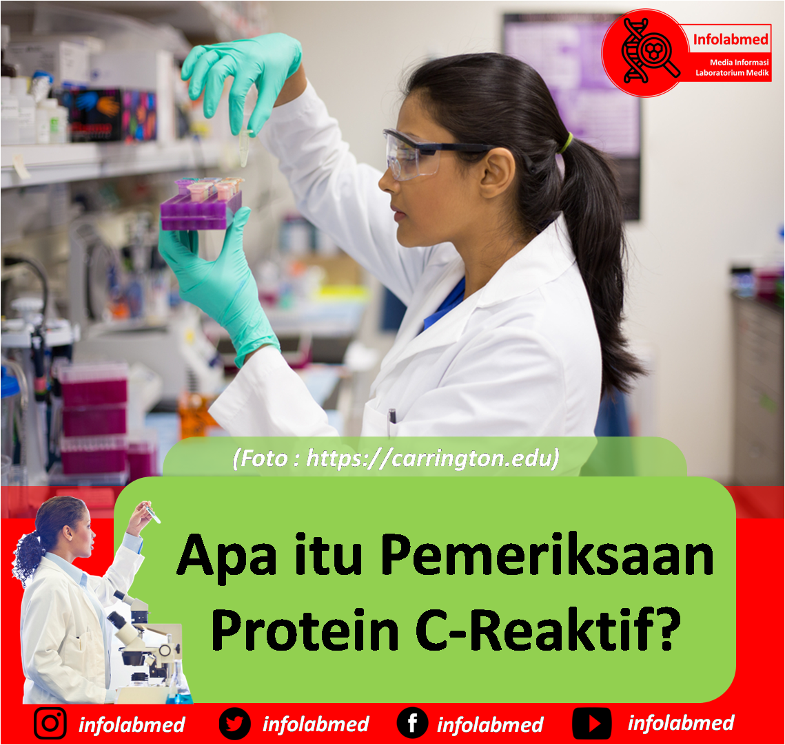 Apa Itu Protein Fungsional - Apa itu Protein【Jenis dan Karakteristik