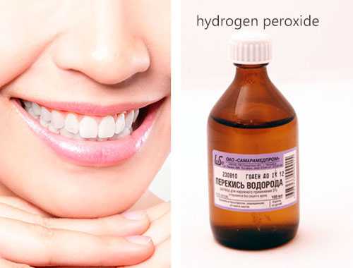 cara memutihkan gigi dengan hidrogen peroksida