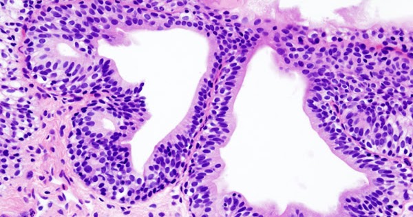 blood in urine after rough sex blood in urine after rough sex