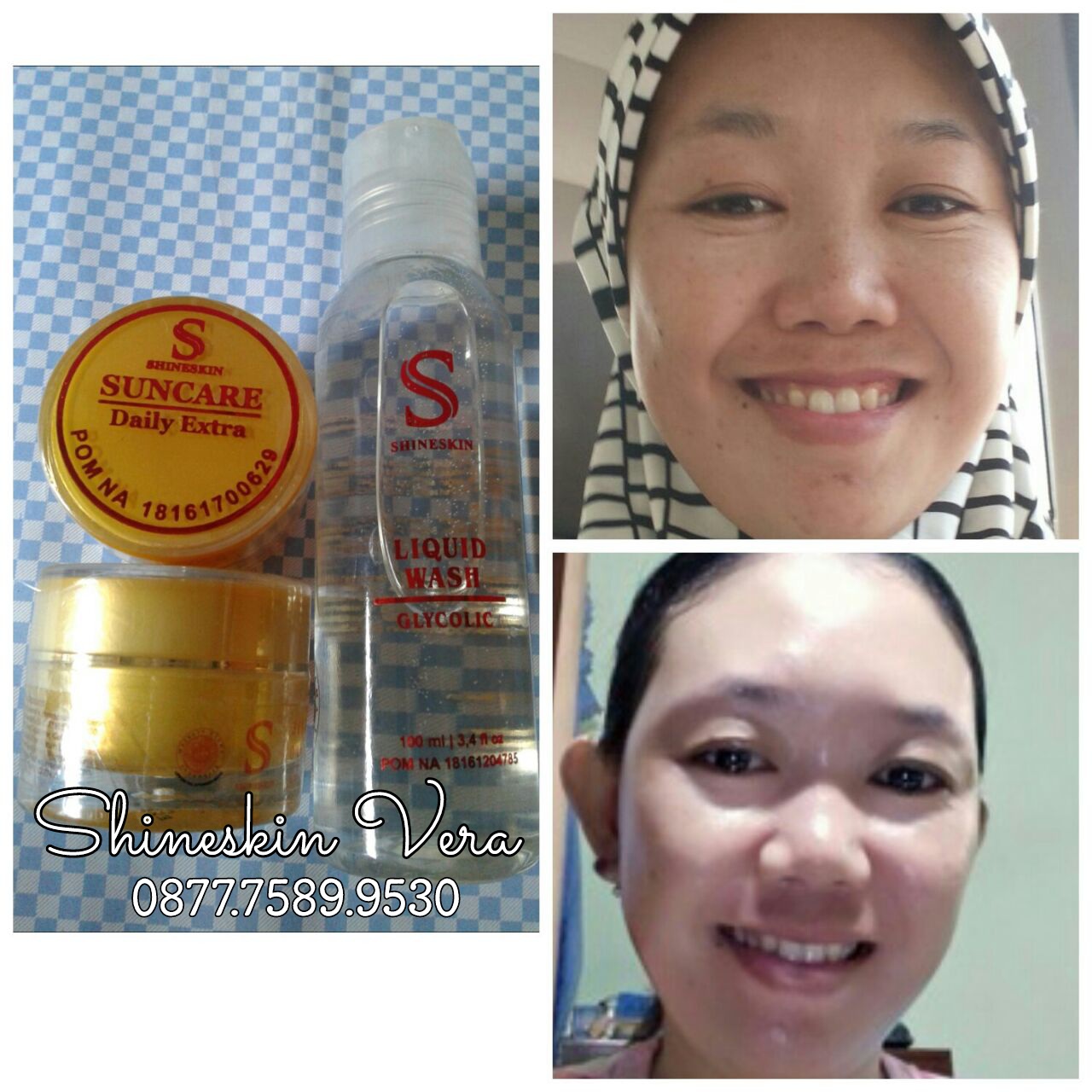 TESTIMONI SHINESKIN ShineSkin Care
