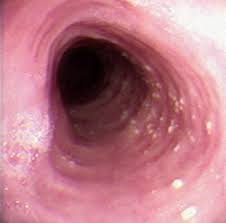 32 Medicine For Megaesophagus In Cats Gif