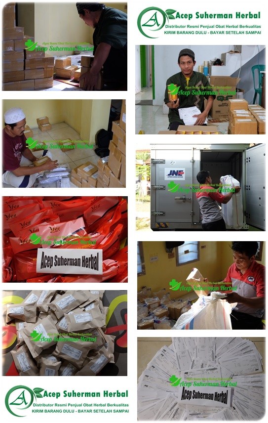 Cara Mengeringkan Luka Jahitan Setelah Melahirkan Cara Mengeringkan Luka Jahitan Setelah Melahirkan
