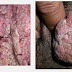 Obat Kutil Kelamin Herbal Tradisional thumbnail