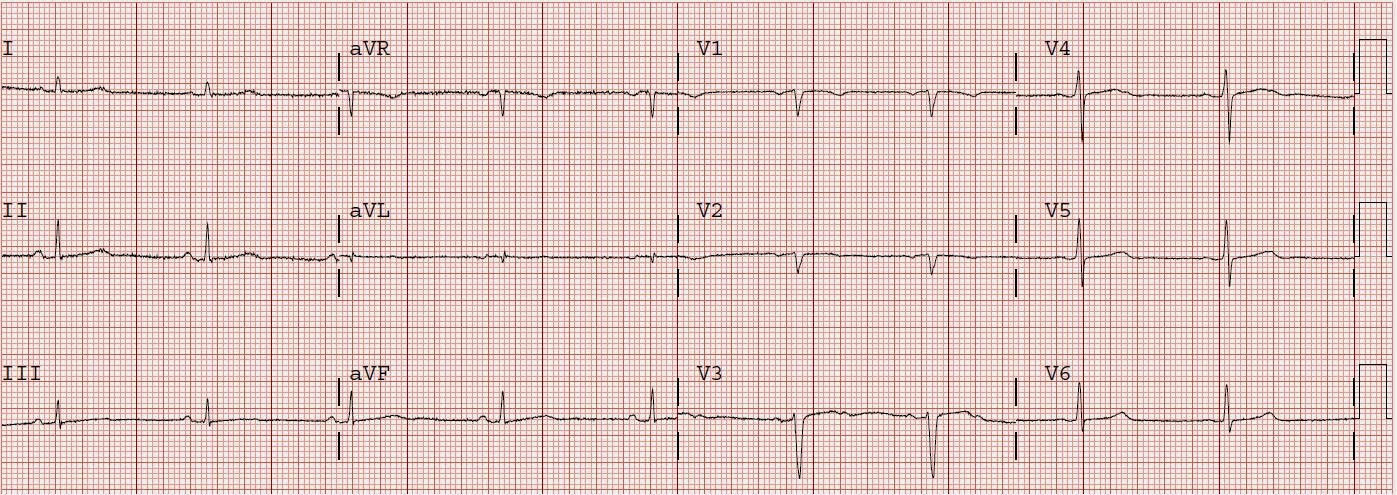waves complete v6 waves complete v6