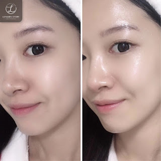 ĐỪNG NHẦM LẪN CẤP NƯỚC VÀ DƯỠNG ẨM! - 3