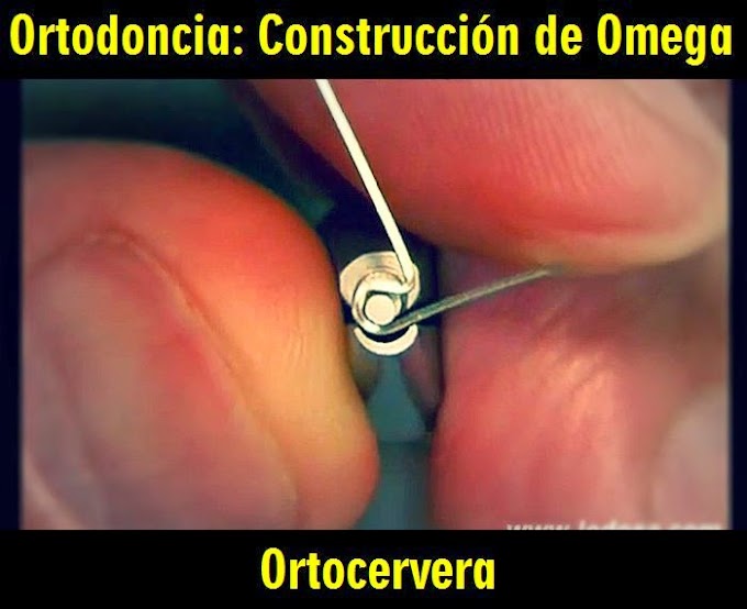 ORTODONCIA: Construcción de Omega