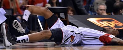 A feast for the eyes!: College basketball player suffers horrible leg injury