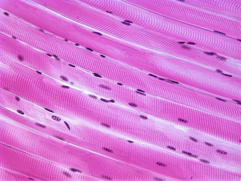 Skeletal Muscle Histology Labeled - vrogue.co