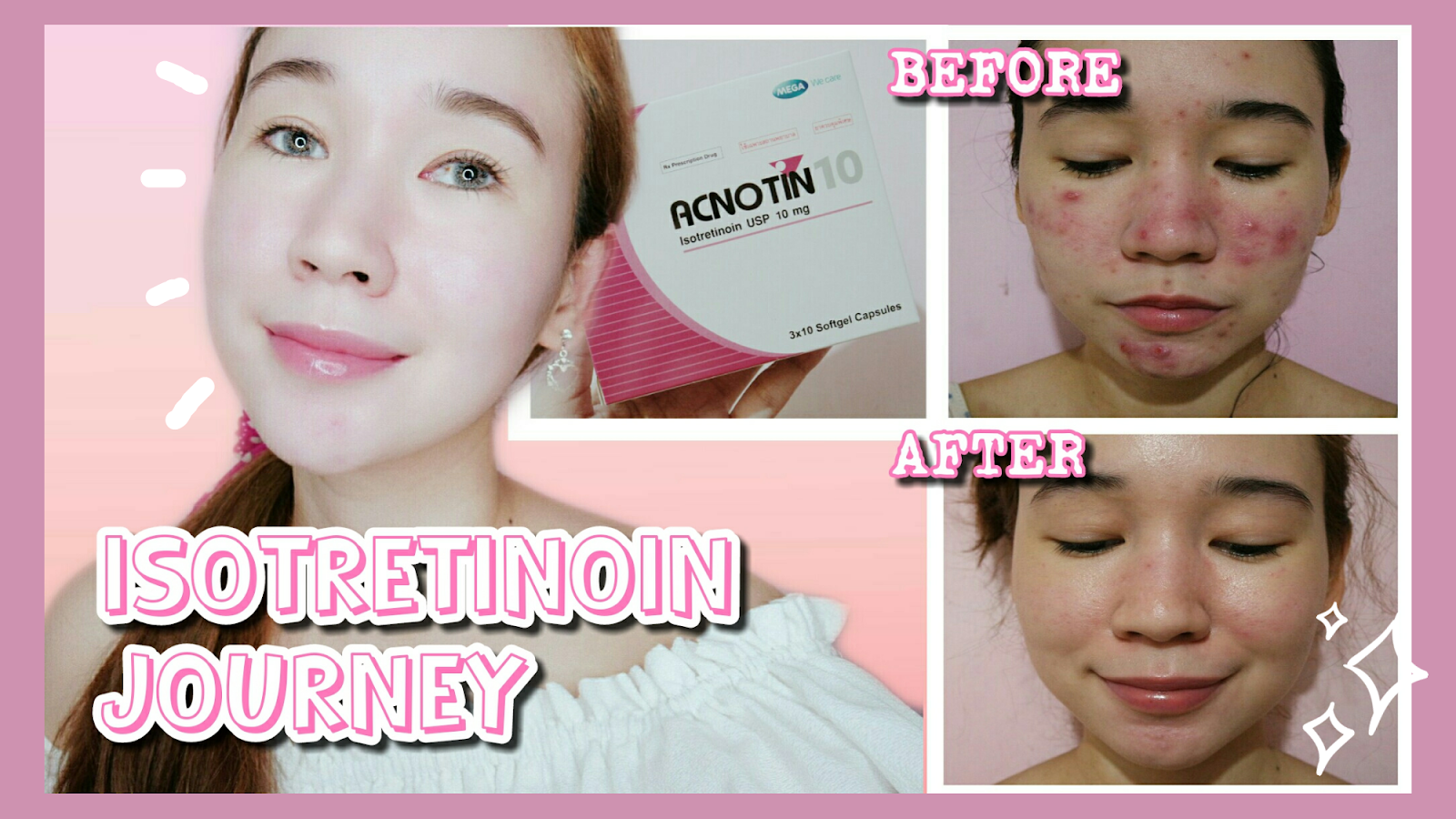 10mg accutane