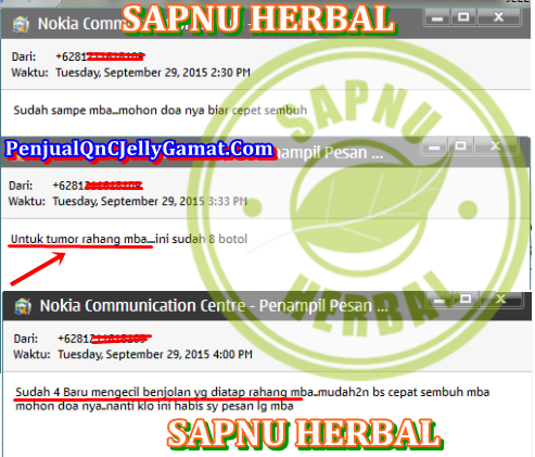 Cara Cepat Menghilangkan Benjolan Kecil Di Kepala Sampai Tuntas Cara Cepat Menghilangkan Benjolan Kecil Di Kepala Sampai Tuntas