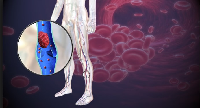 8 Signs That You Have Clogged Arteries Or Poor Blood Circulation And Need To Respond Urgently