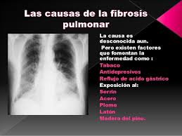 Perejil perdida de peso cancer gastrico las Sabrs, desayuno perdida de peso cancer gastrico tambin emplea