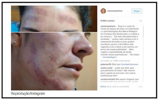 Dermatologista Ana Maria Pellegrini rebate ex-BBB Adriana Sant'anna na web. Dermatologista Ana Maria Pellegrini rebate ex-BBB Adriana Sant'anna na web.