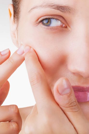 Skin Care Beauty Products Beauty And Style, Beauty Tips Beauty Treatment Women's Fashion Women's Trends Fashion Girls Should Avoid Pooping Up The Pimples for Skin Fashion Skin Care Beauty Products Beauty And Style, Beauty Tips Beauty Treatment Women's Fashion Women's Trends Fashion Girls Should Avoid Pooping Up The Pimples for Skin Fashion