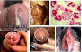 Foto Cara Paling Cepat Mengobati Kemaluan Keluar Nanah Dan Perih Saat Kencing obat herbal sembuhkan gejala sipilis