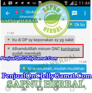 Cara Mengobati Penyakit Kuning Pada Orang Dewasa dan Anak-anak, Terbukti Manjur Cara Mengobati Penyakit Kuning Pada Orang Dewasa dan Anak-anak, Terbukti Manjur