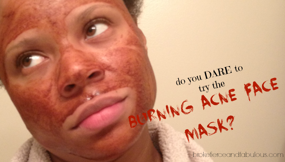 clear and masks mask acne persistent embarrassing diy scars  skin my clear help for face acne to