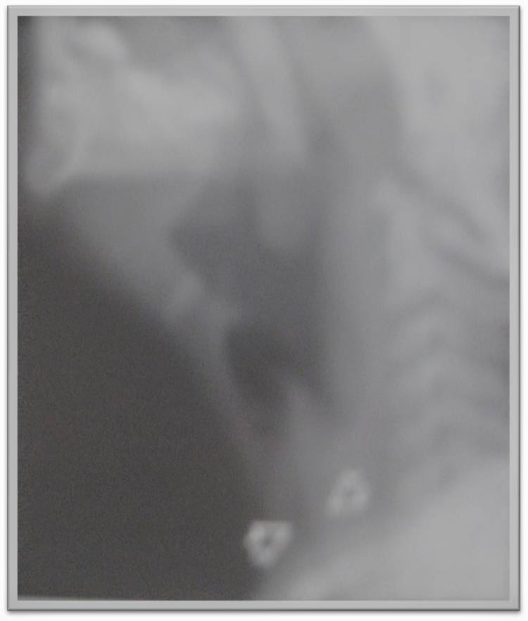My Image 53