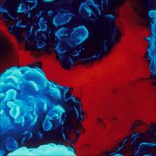 LIVING BY NUCLEAR PLANTS DO NOT HAVE AN INCREASED RISK OF LEUKAEMIA ...