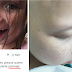 Padre comparte la foto de la última pestaña de su hija con cáncer; te romperá el corazón su publicación.