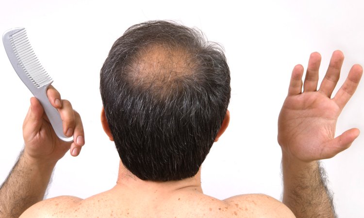 Los medios del enderezamiento químico de los cabello