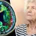 Scientists Cure Alzheimer's In Mice, Giving Hope For The Future
