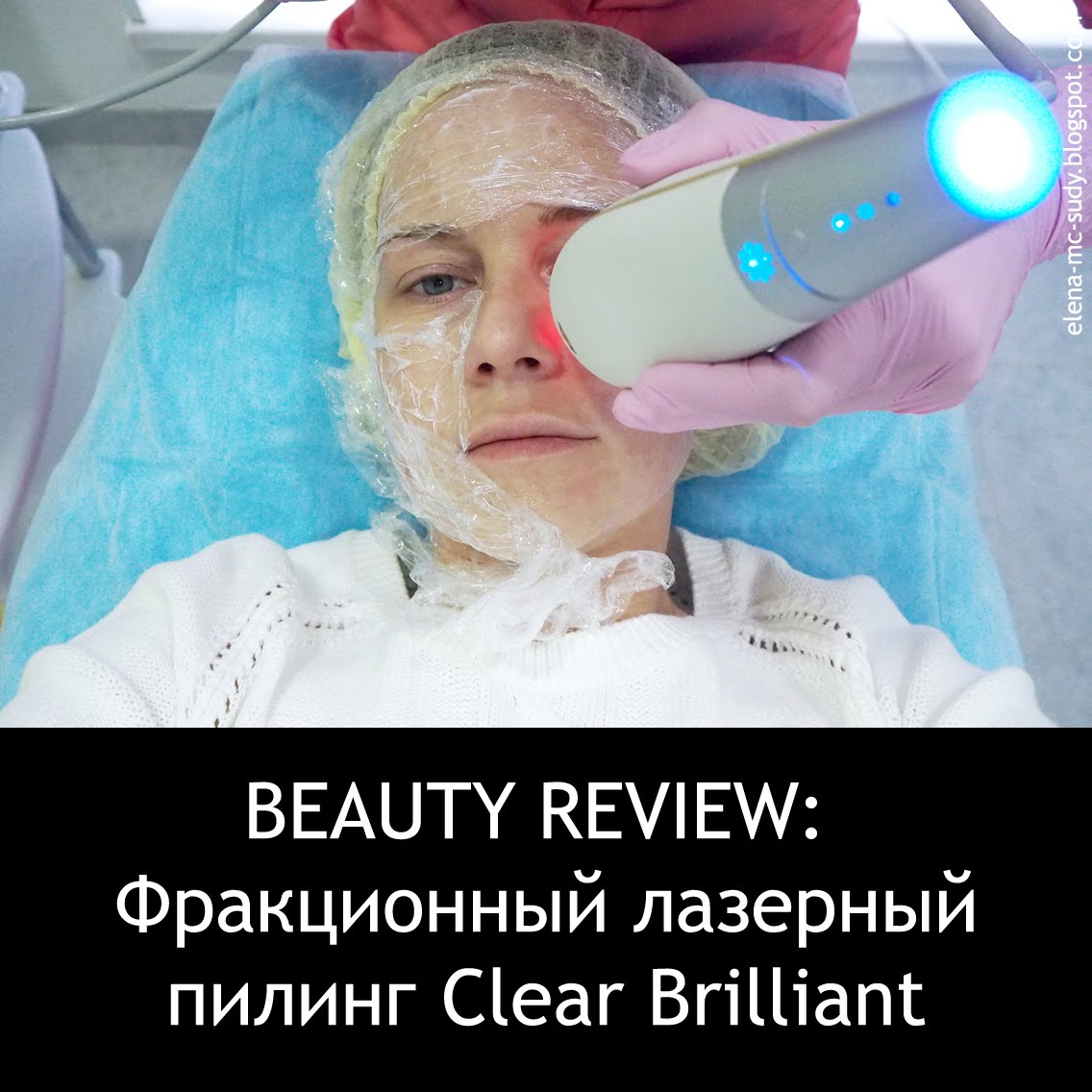 Лазерное омоложение Clear+Brilliant