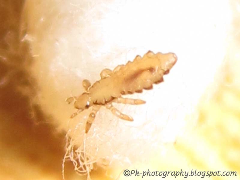 Head Lice Life Cycle Nature, Cultural, and Travel Photography Blog