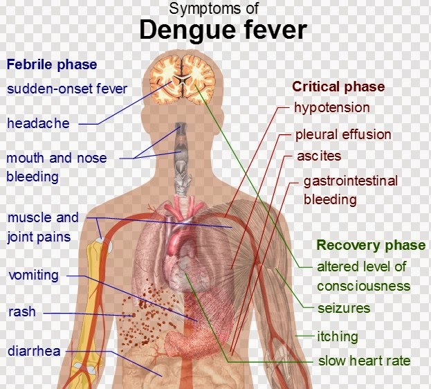 An essay on dengue fever