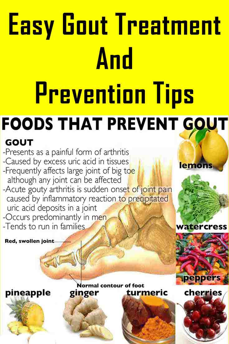 Easy Gout Treatment and Prevention Tips Easy Gout Treatment and