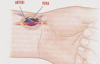 Perbedaan Vena dan Arteri