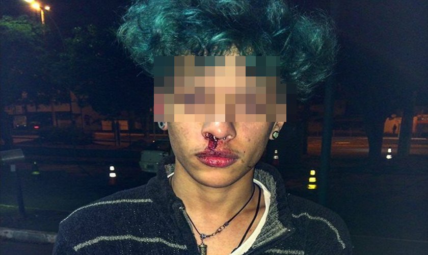 Cinco jovens LGBT são agredidos em shopping no Distrito Federal Cinco jovens LGBT são agredidos em shopping no Distrito Federal