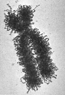 An electron micrograph of a human chromosome