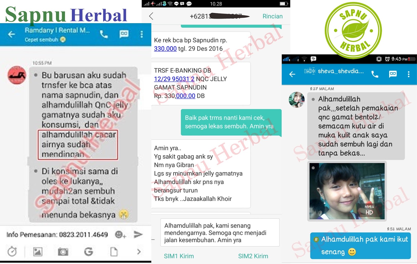 Testimoni QnC Jelly Gamat Testimoni QnC Jelly Gamat