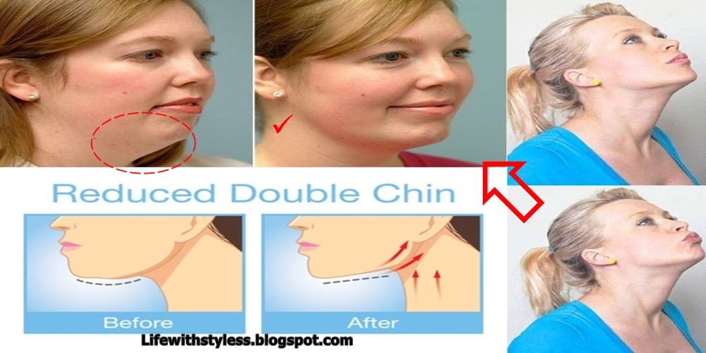 Incredible Exercises That Will Tighten Up your Loose Skin and Eliminate