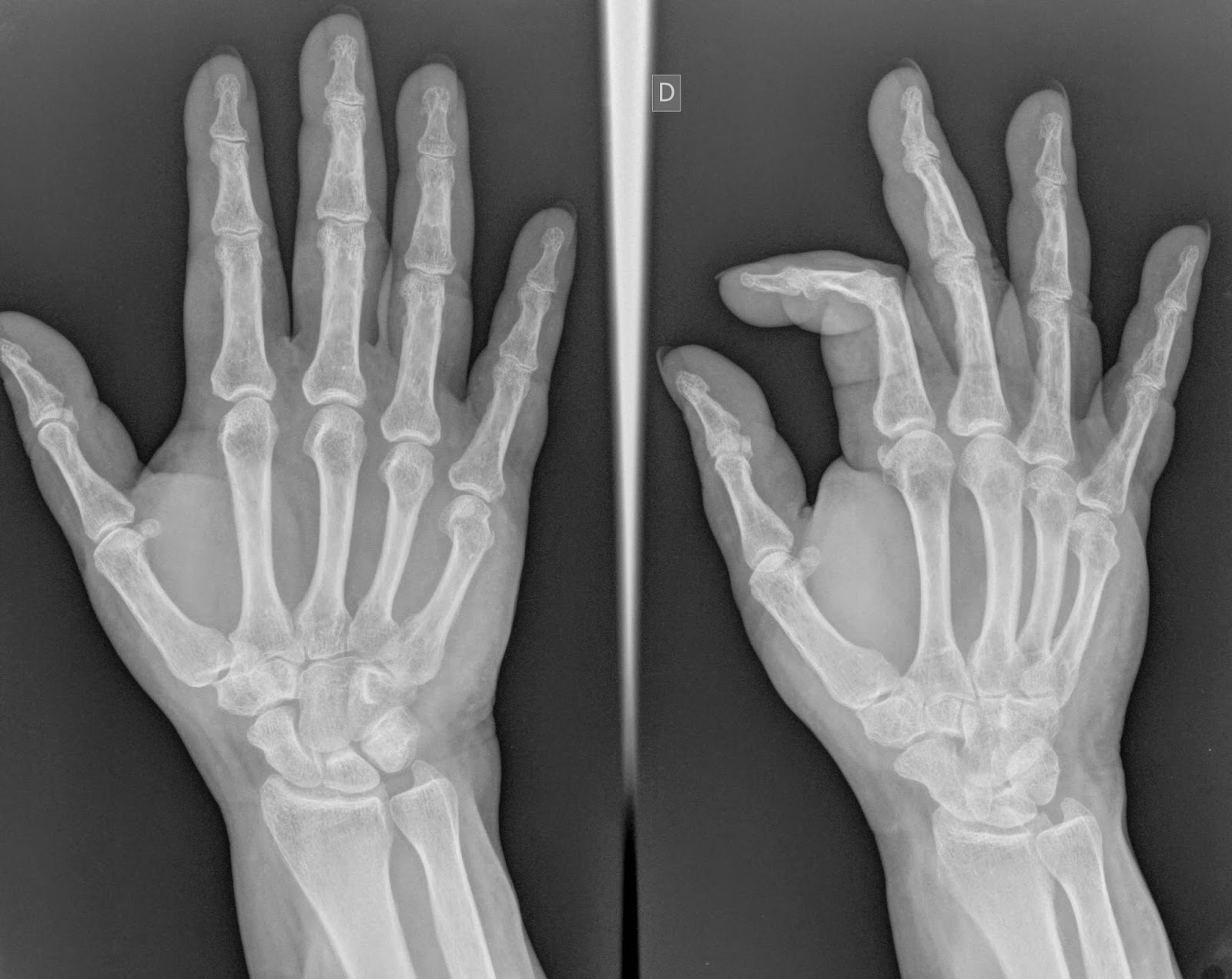 ESKUAK / UKABILAK BAGA BIGA BLOG!