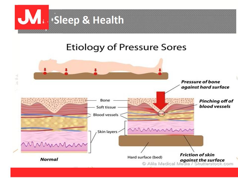 Therapy mattress for rheumatic arthritis, high cholesterol, insomnia