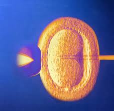 http://mannatfertility.com/Intra-Cytoplasmic-sperm-Injection-ICSI.php