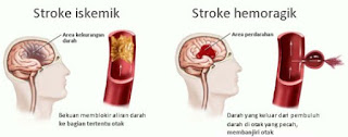 Cara minum rebusan daun sirsak yang benar efek samping daun sirsak terhadap kesuburan, cara merebus daun sirsak untuk kolesterol, cara merebus daun sirsak untuk asam urat, cara merebus daun sirsak untuk diabetes, manfaat daun sirsak untuk tumor, cara mengolah daun sirsak untuk obat jantung, cara merebus daun sirsak untuk kista, cara merebus daun sirsak dan kulit manggis