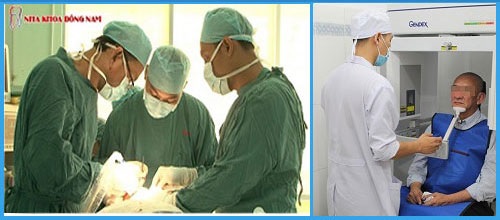 Mất nguyên hàm cần cấy bao nhiêu trụ Implant MẤT NGUYÊN HÀM CẦN CẤY BAO NHIÊU TRỤ IMPLANT