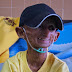 Falleció "joven" Wayúu con síndrome de envejecimiento prematuro (Info + Foto)