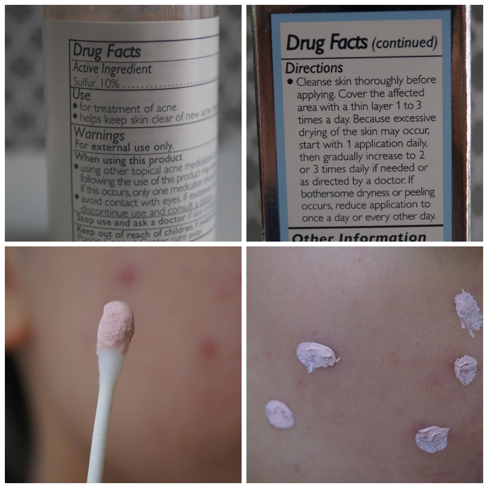 Rouge de Amour Kate Somerville EradiKate Acne Treatment Review